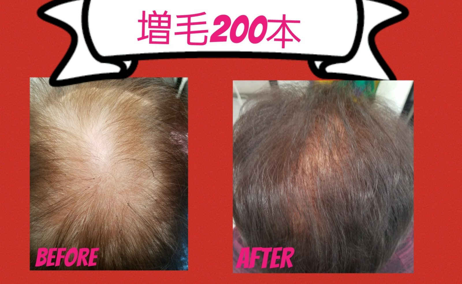 18-02-28-19-32-38-306_deco